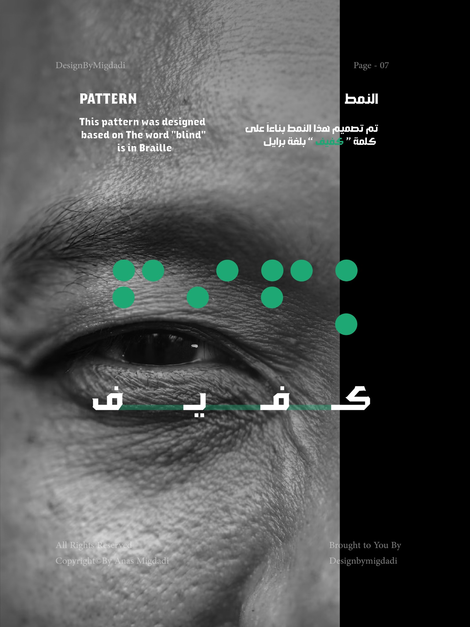 The Braille-based supporting pattern.